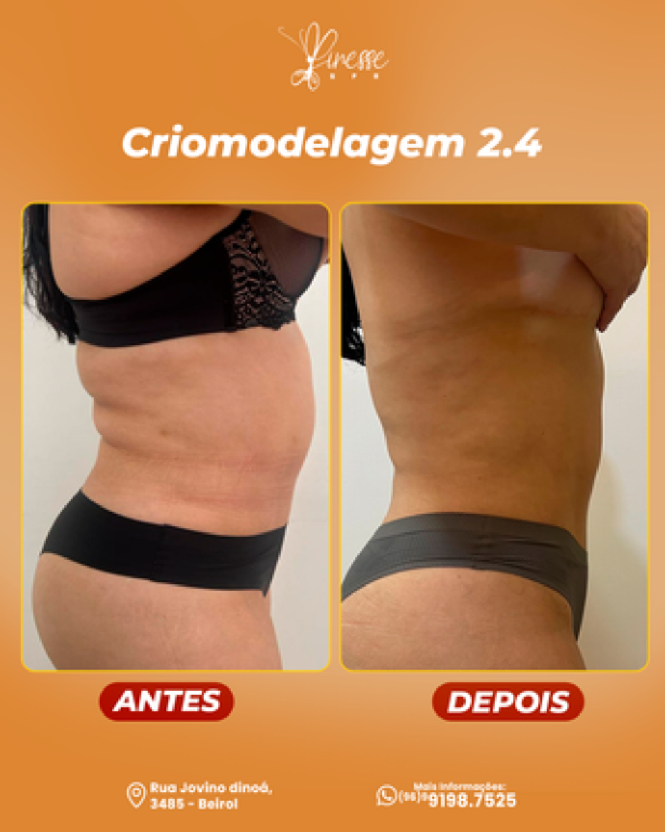 Antes e depois