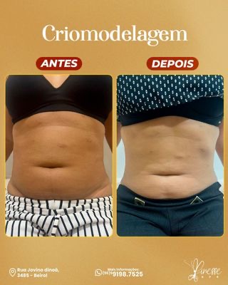 Resultado do procedimento